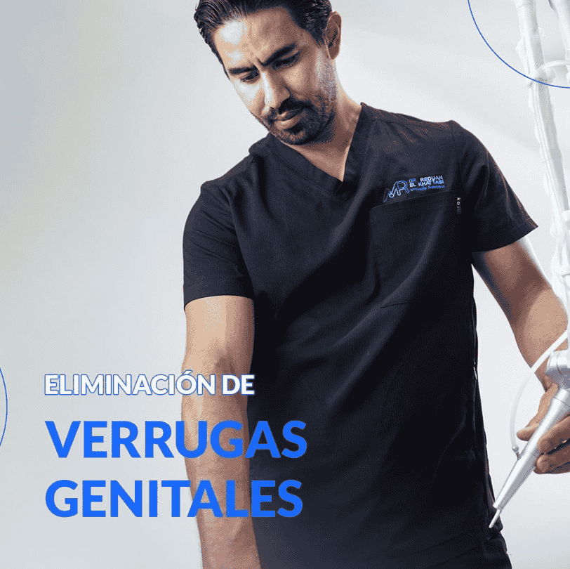 Eliminación de verruga con láser CO2