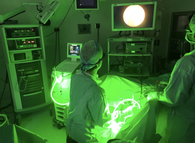 Operación de próstata con fotovaprización selectiva